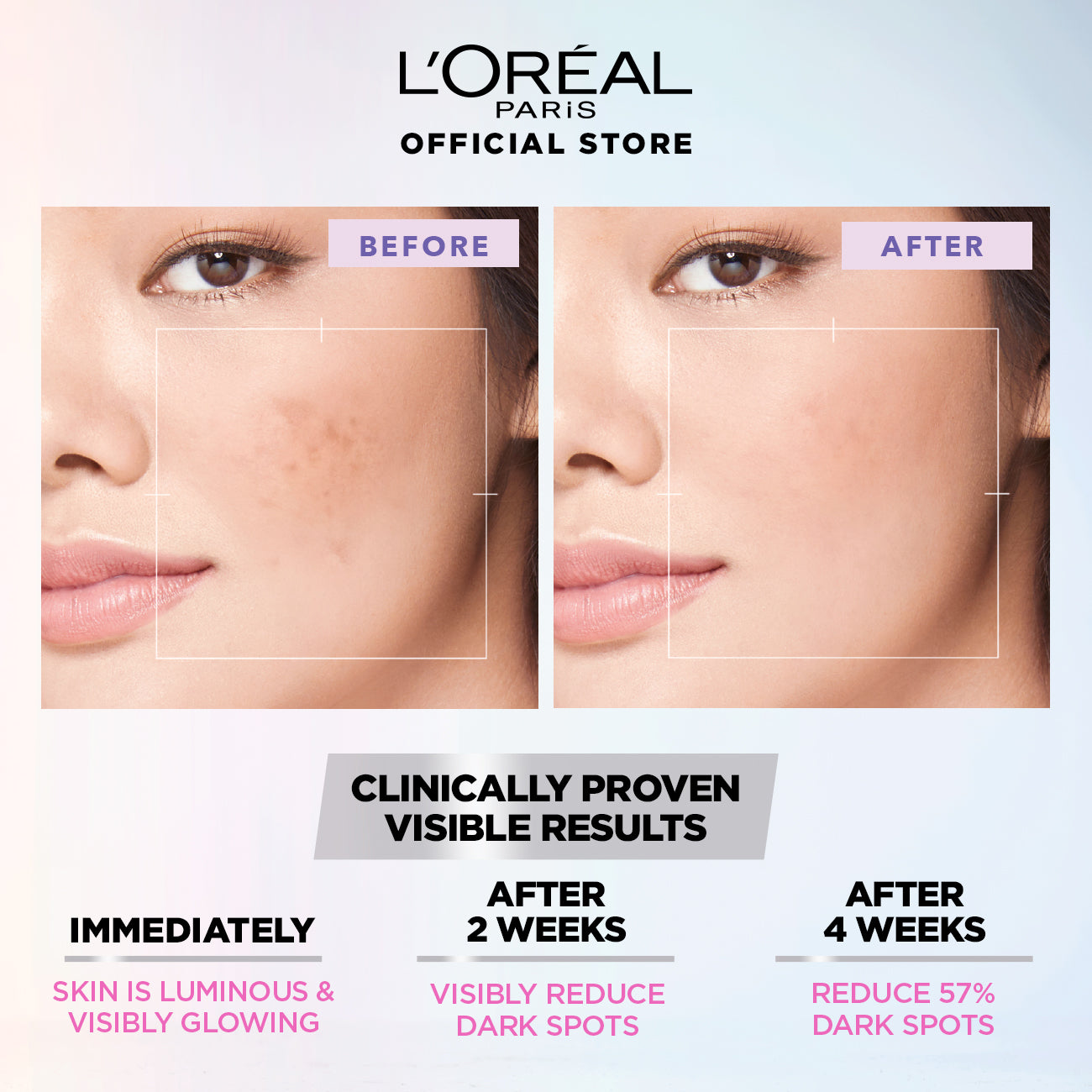LOreal Paris - Glycolic Bright Glowing Daily Face Wash - 100ml