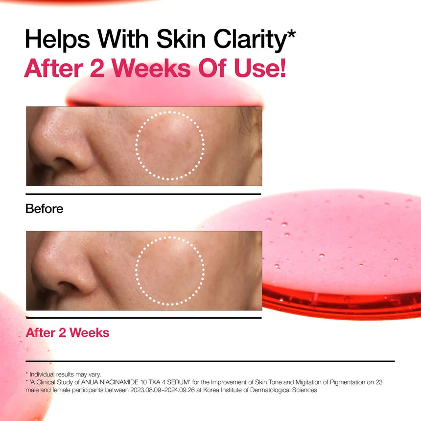 Anua - Niacinamide 10% + TXA 4% Serum 30Ml