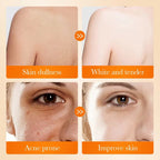 Sadoer - Kojic Acid Whitening Soap
