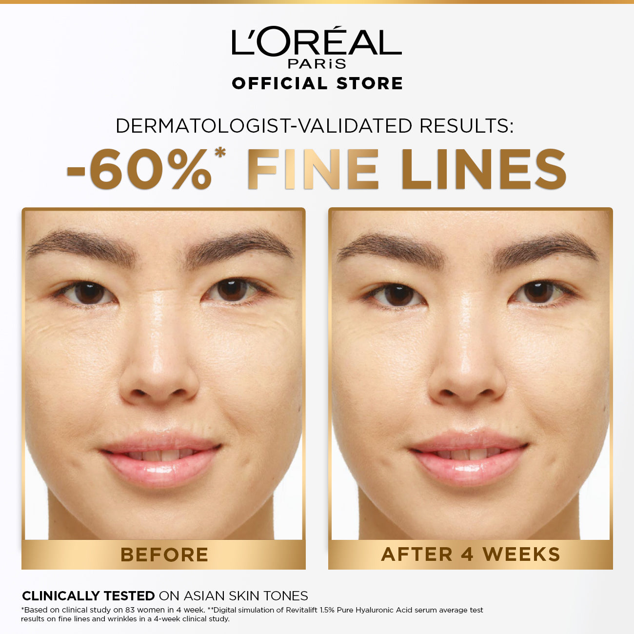 LOreal Paris - Revitalift 1.5% Hyaluronic Acid Face Serum 30 ML