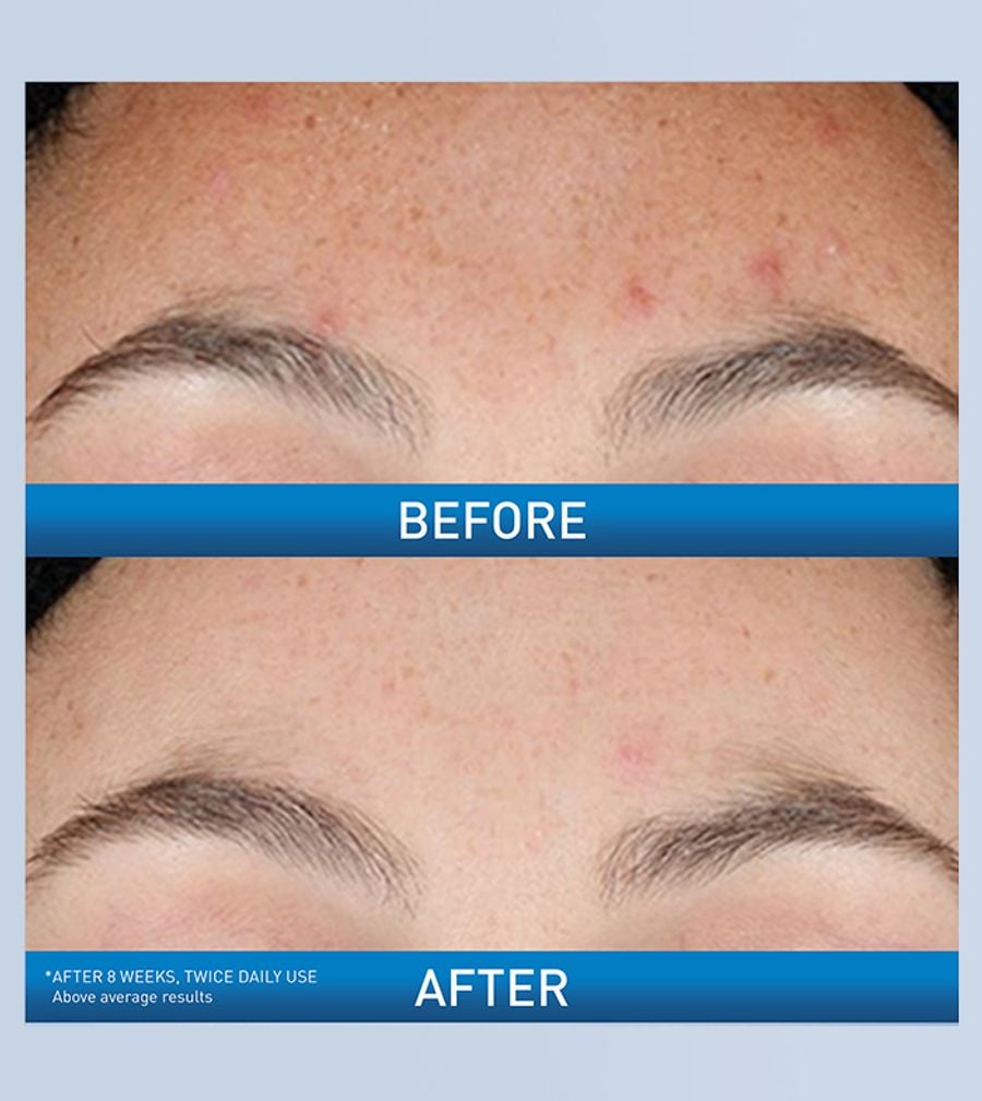 CeraVe - Resurfacing Retinol Serum 30ml