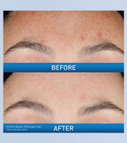 CeraVe - Resurfacing Retinol Serum 30ml